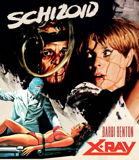 Schizoid (1980) / Det 4. Offer + XRay (1981) (Aka Hospital Massacre)