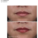 Dr Dennis Gross DermInfusions™ Plump + Repair Lip Treatment 10 ml